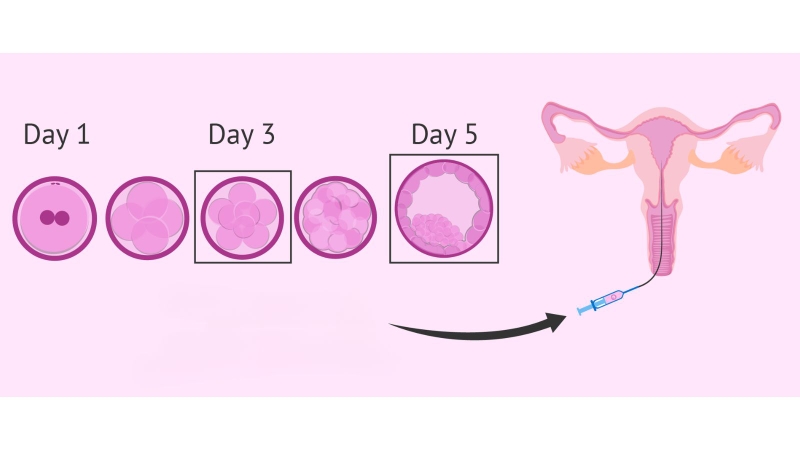 vi-sao-phoi-khong-bam-vao-tu-cung-nhung-dieu-can-biet 4