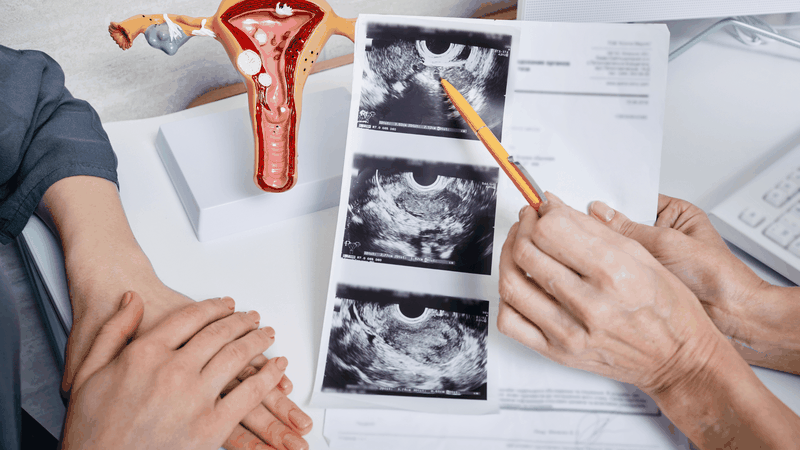 Nguyên nhân sinh non: Giải đáp chi tiết 3