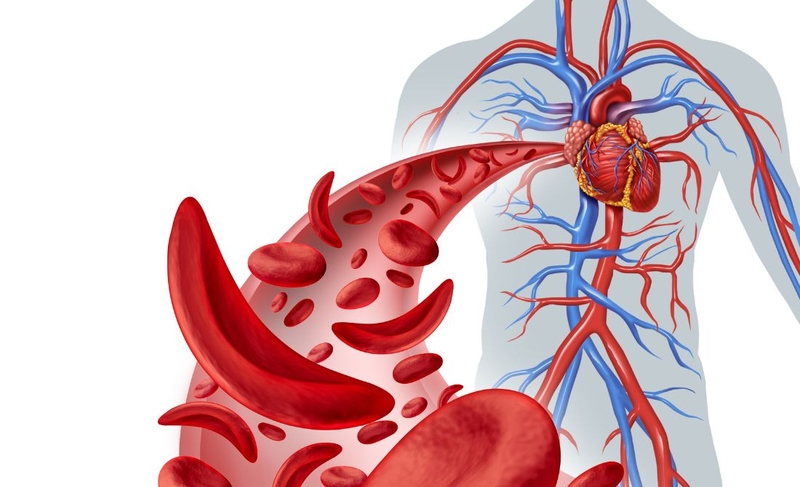 Tổng hợp nguyên nhân thiếu máu​ phổ biến nên biết để tránh 2