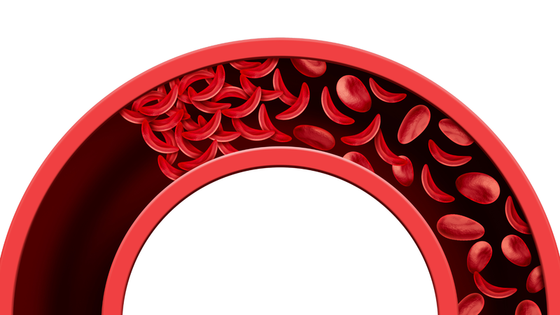 Nguyên nhân thiếu máu và các xét nghiệm đánh giá thiếu máu bạn cần biết 2