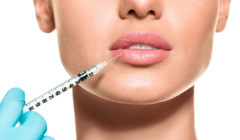 Nguyên nhân tiêm filler môi 2 tháng bị sưng? Có cách khắc phục không? 1