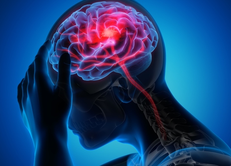 Nguyên nhân, triệu chứng và cách phòng ngừa đột quỵ vào sáng sớm 1