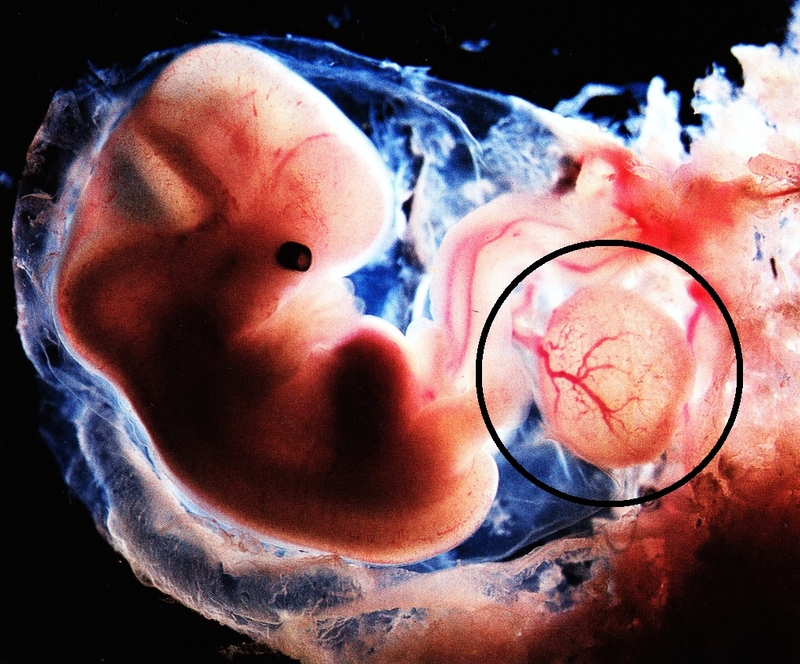 Nguyên nhân túi noãn hoàng to hơn bình thường là gì? Cách chăm sóc sản phụ thời kỳ đầu 1