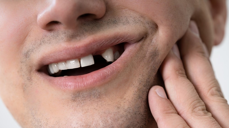 Nguyên nhân tủy răng bị thối và cách khắc phục 2