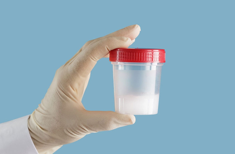 Tinh trùng bình thường có mùi như amoniac