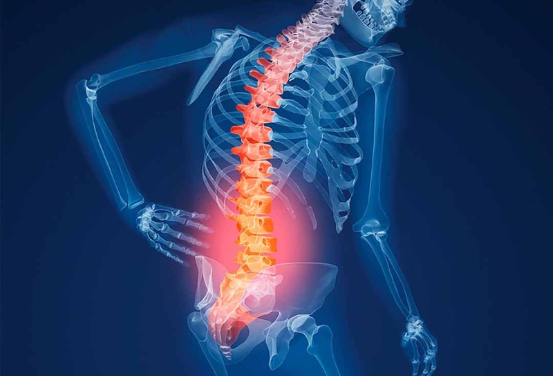 Loãng xương phát triển đến một mức độ nhất định có thể gây ra các cơn đau khớp như đau vai, cột sống và thắt lưng