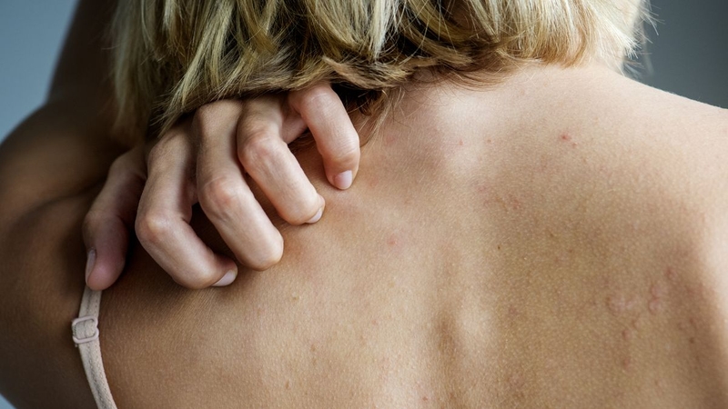 Nguyên nhân và cách điều trị khi bị ngứa toàn thân 1