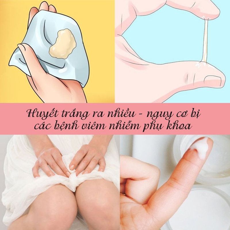 Tình trạng ngứa vùng kín và có dịch trắng.