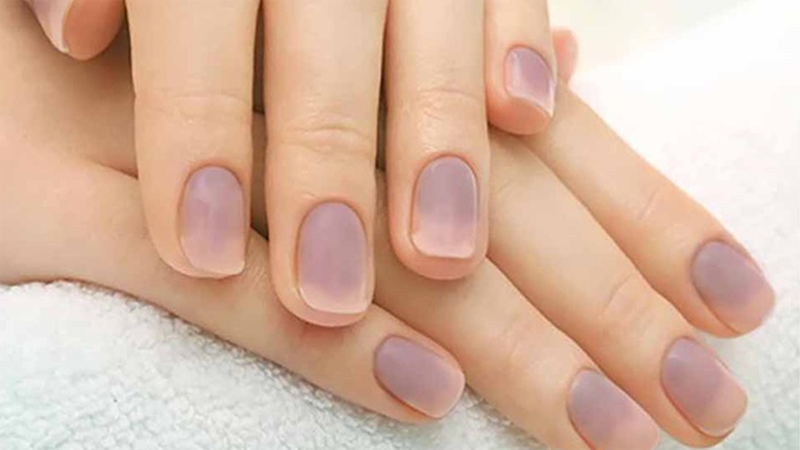 Nguyên nhân và cách khắc phục việc gắn móng giả bị xanh móng 2