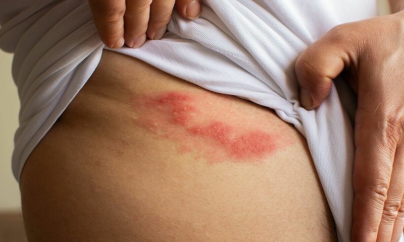 nguyen-nhan-va-cach-nhan-biet-khi-mac-zona-than-kinh-o-mong 1.jpg