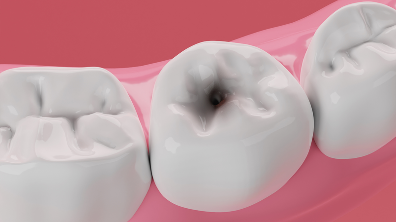 Nguyên nhân và cách phòng ngừa ê buốt răng hàm 2