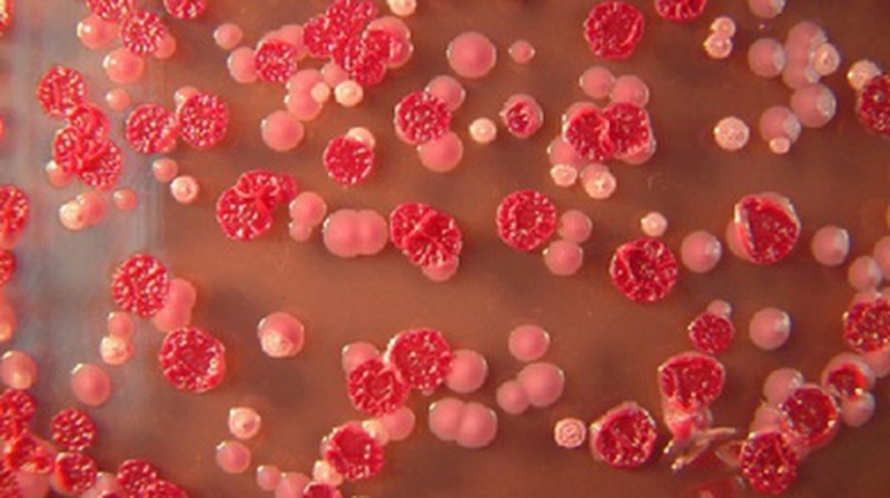 Nguyên nhân và cách phòng tránh bệnh Whitmore