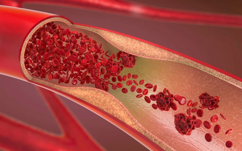 nguyen-nhan-va-cach-phong-tranh-ngat-do-thieu-mau-nao 3.jpg