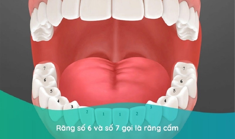 Nguyên nhân và cách xử lý răng cấm bị sâu