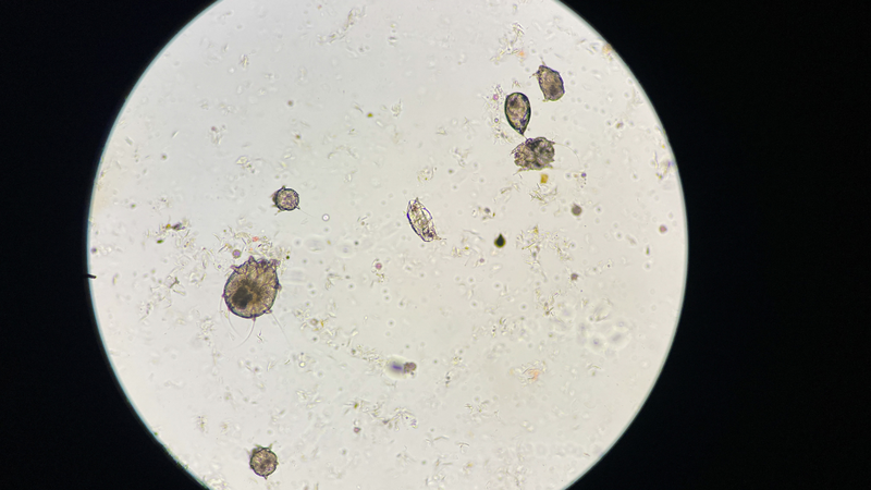 Bệnh ghẻ là bệnh da liễu do ký sinh trùng gây ra,