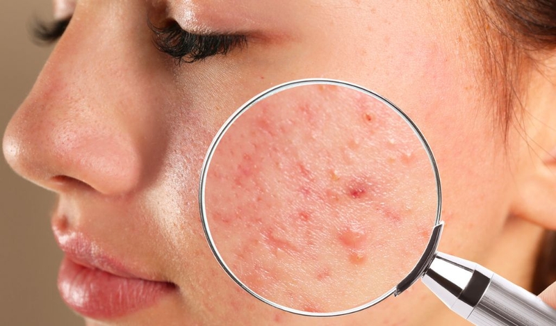 Nha đam có tác dụng gì cho da mặt? Cách sử dụng hiệu quả? 2