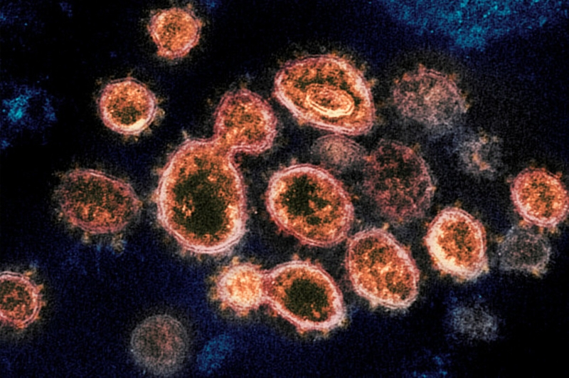 Nhà khoa học Mỹ tìm thấy virus Sars-CoV-2 trong tinh hoàn bệnh nhân 1