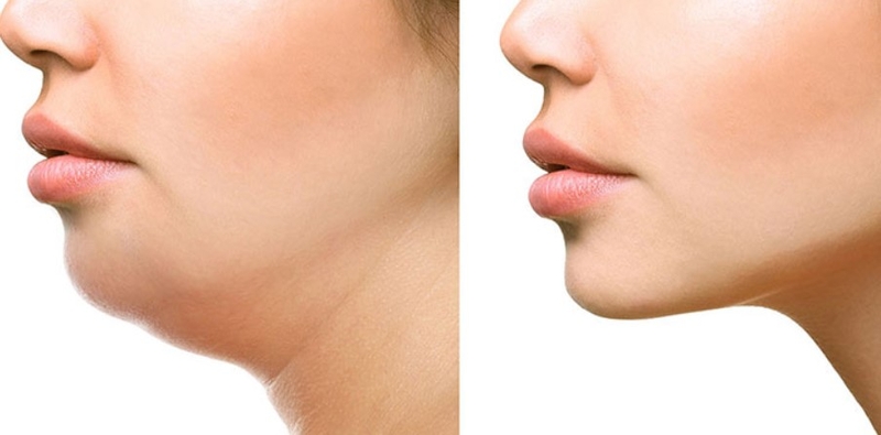 Nhai kẹo cao su có giảm béo mặt 2