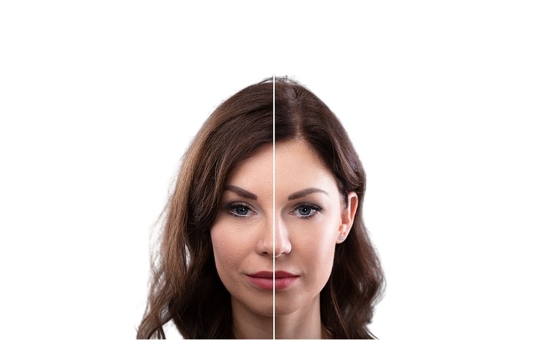 Nhai nhiều 1 bên thì bên nào to hơn​? Khắc phục thói quen nhai 1 bên 2