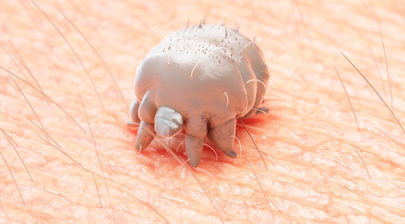 Nhận biết bệnh ghẻ xốn và cách điều trị 2