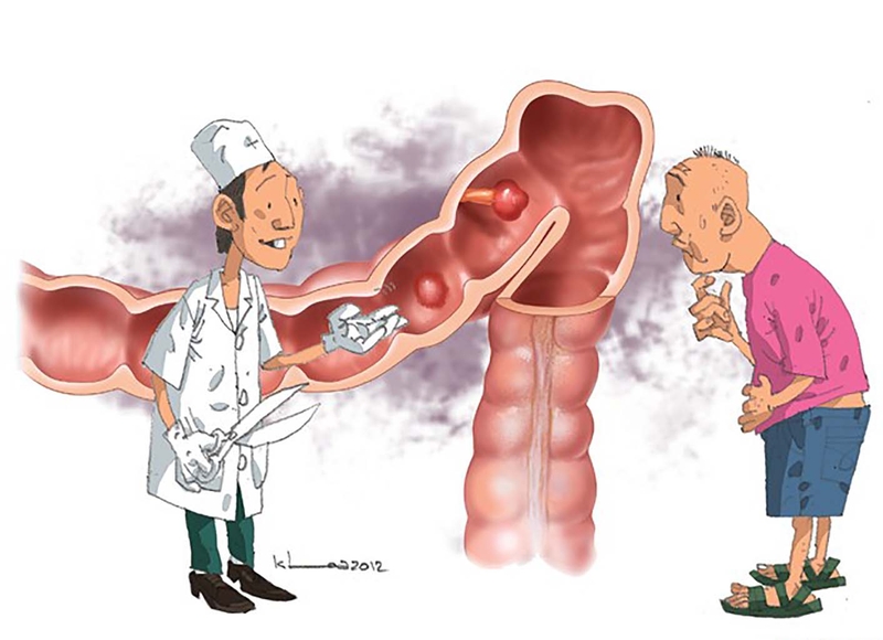 Nhận biết bệnh viêm đại tràng dạ dày qua những biểu hiện này 1