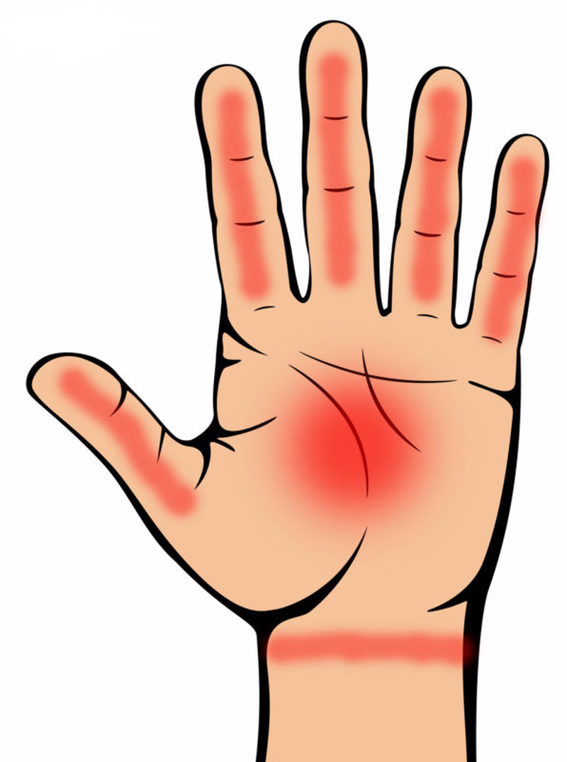 Nhận biết dấu hiệu bệnh tiểu đường thông qua bàn tay cực đơn giản 1