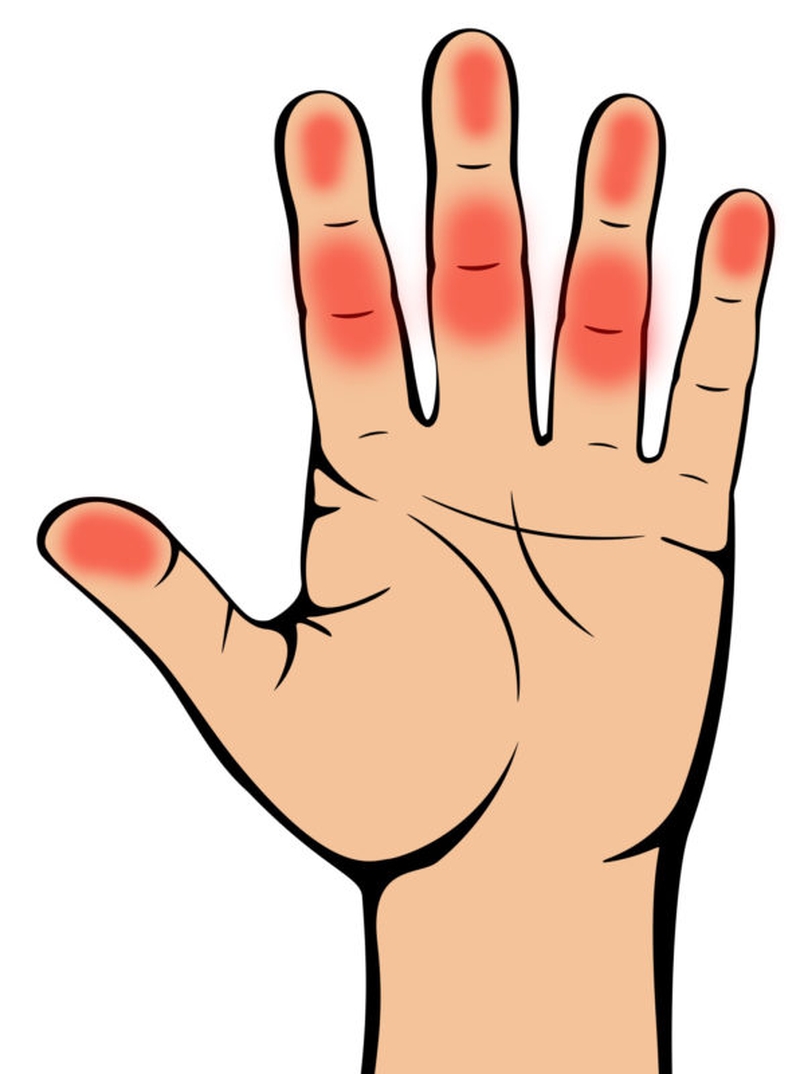 Nhận biết dấu hiệu bệnh tiểu đường thông qua bàn tay cực đơn giản 3