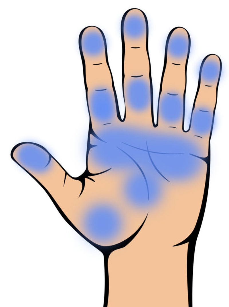 Nhận biết dấu hiệu bệnh tiểu đường thông qua bàn tay cực đơn giản 7