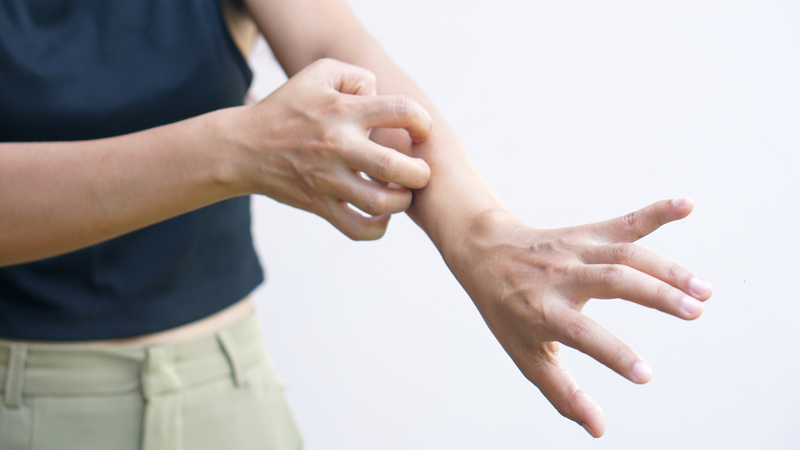 Nhận biết dấu hiệu sốt phát ban dạng sởi 2