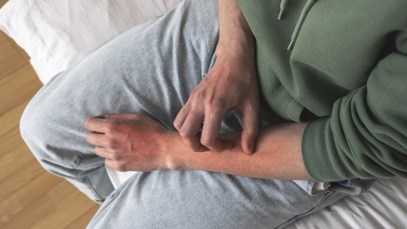 Nhận biết dấu hiệu sốt phát ban dạng sởi 3