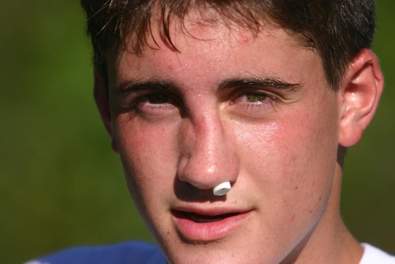 Nhận biết hiện tượng sau khi nâng mũi bình thường và không bình thường 2