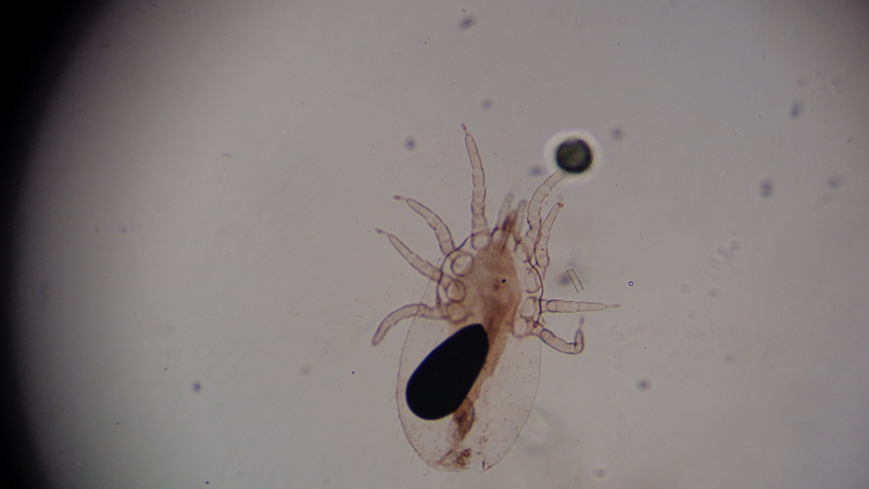 Tác nhân gây bệnh ghẻ là ký sinh trùng Sarcoptes scabiei