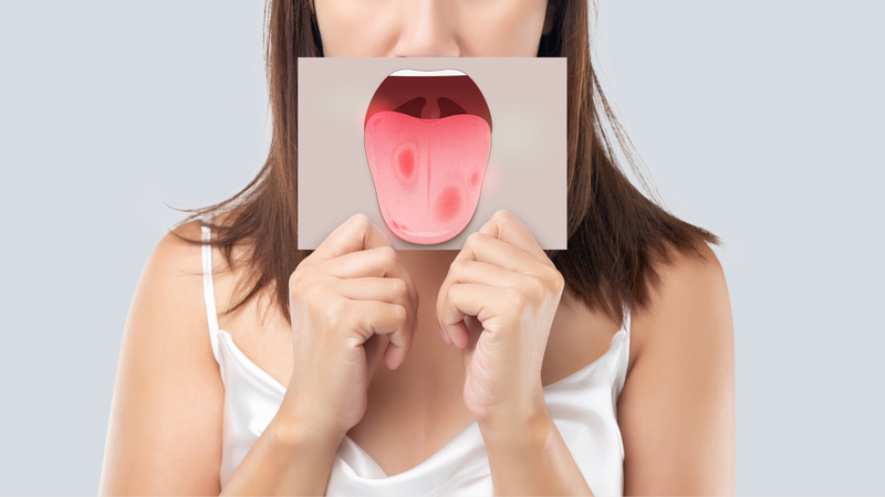 Đau lưỡi không rõ nguyên nhân là dấu hiệu cảnh báo ung thư lưỡi