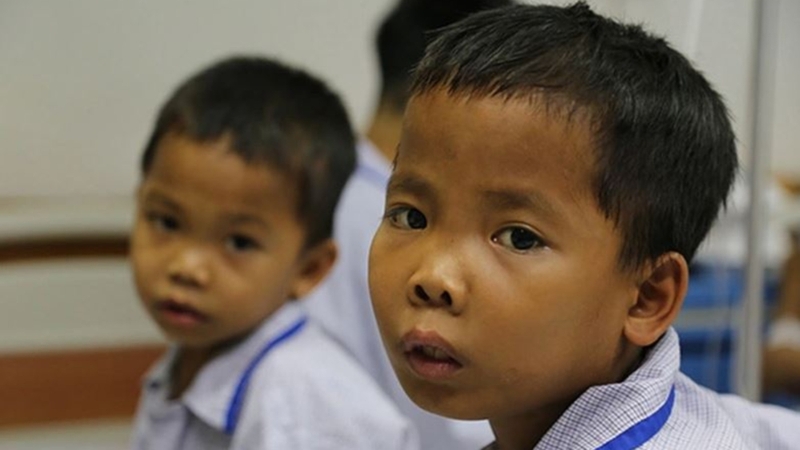 Nhận biết dấu hiệu bệnh qua hình ảnh trẻ bị tan máu bẩm sinh