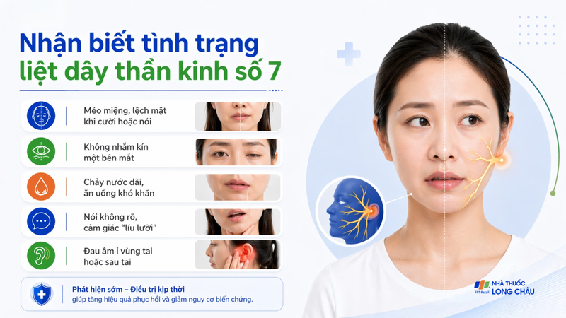 Nhận biết tình trạng liệt dây thần kinh số 7