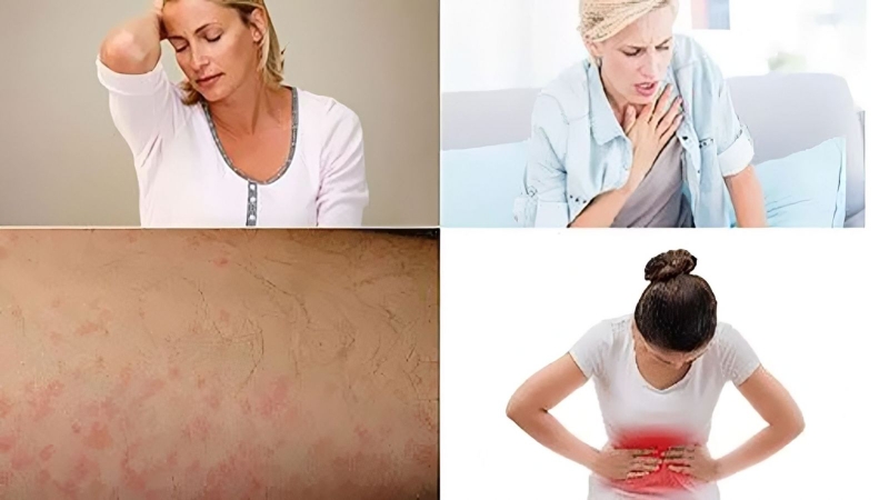 nhan-biet-va-xu-tri-khi-bi-di-ung-thuoc-tay 4