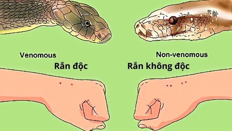 Sơ cứu khi rắn biển cắn hiệu quả