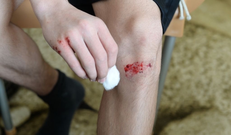 Nhận biết vết thương bị nhiễm trùng như thế nào? Có cách điều trị không? 1