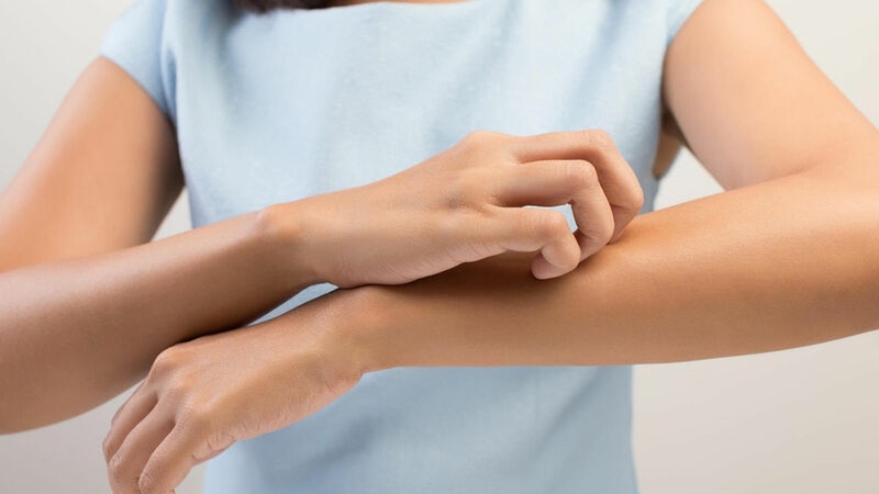 Nhận diện dấu hiệu sán mèo lây sang người mà bạn nên biết 3