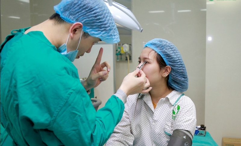 Nhấn mí mắt giá bao nhiêu? Yếu tố ảnh hưởng đến chi phí nhấn mí? 2