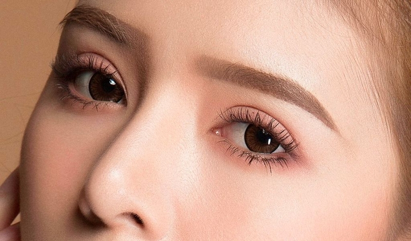 Nhấn mí Plasma là gì? Có hiệu quả không và duy trì kết quả được bao lâu? 3