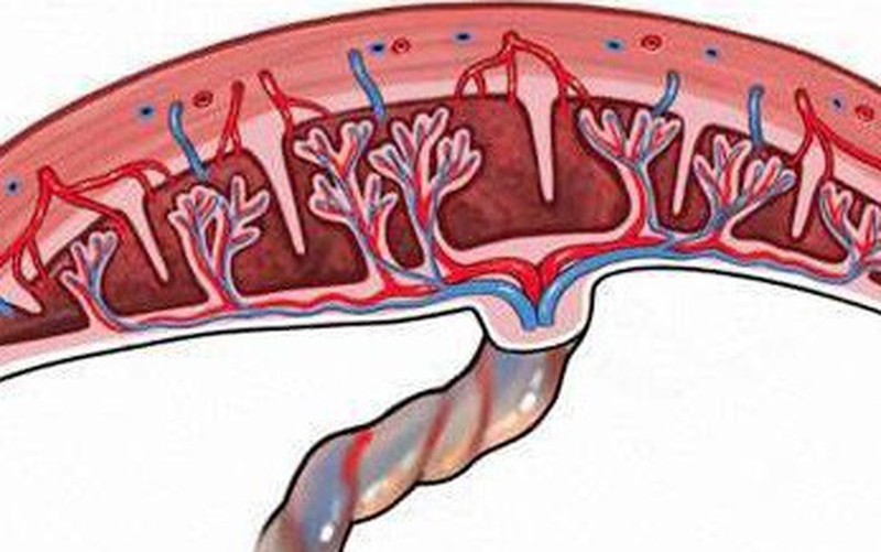 Nhau cài răng lược là một trong những “thủ phạm” gây ra tình trạng chảy máu nhiều sau sinh, rối loạn đông máu