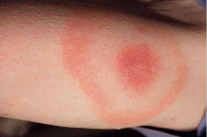 nhện nhà có độc không 2