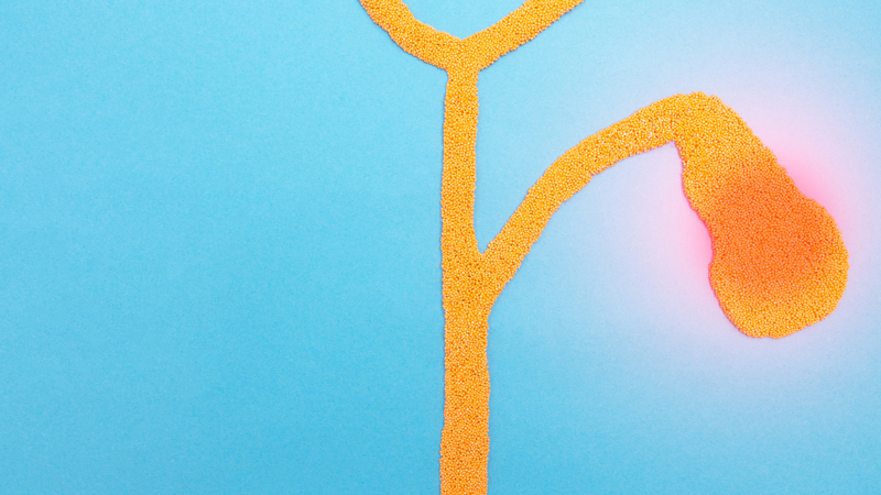 nhiem-cholesterol-thanh-tui-mat-la-gi (1).png