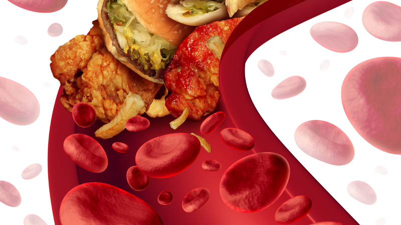 nhiem-cholesterol-thanh-tui-mat-la-gi (2).png