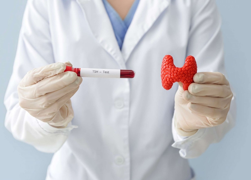 Nhiễm độc giáp Triệu chứng và phương pháp điều trị 2