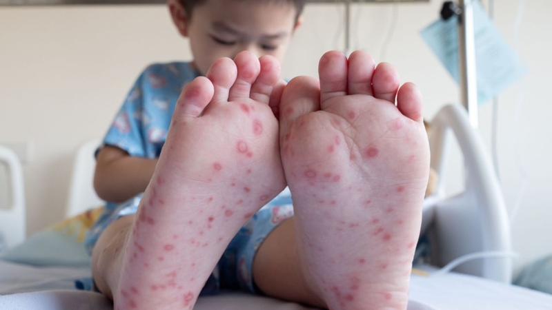 Chăm sóc đúng cách giúp giảm nguy cơ biến chứng thần kinh