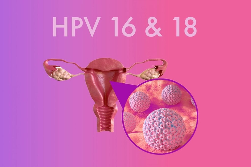 Nhiễm HPV type 16 có chữa được không? Biện pháp phòng tránh nhiễm HPV 16 2