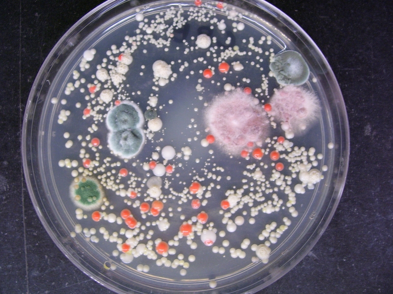 Nhiễm khuẩn ổ bụng: Nguyên nhân, triệu chứng và cách khắc phục 2