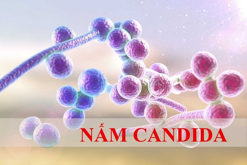 Nhiễm nấm Cadida âm đạo có chữa được không? 1